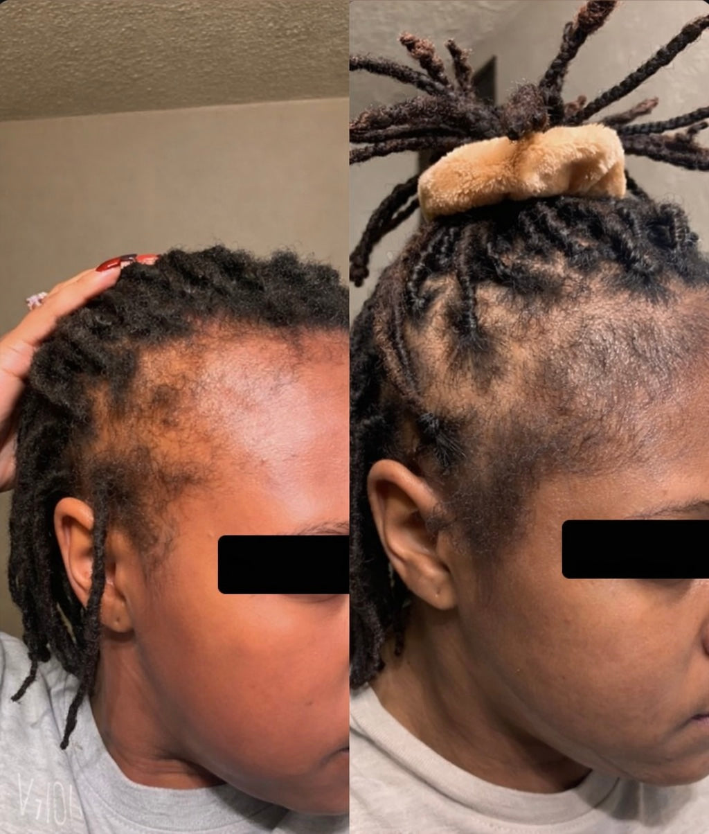 Meghan - Rosemary Hair Growth Oil – Stimulate Stronger, Fuller, Faster-Growing Hair Naturally