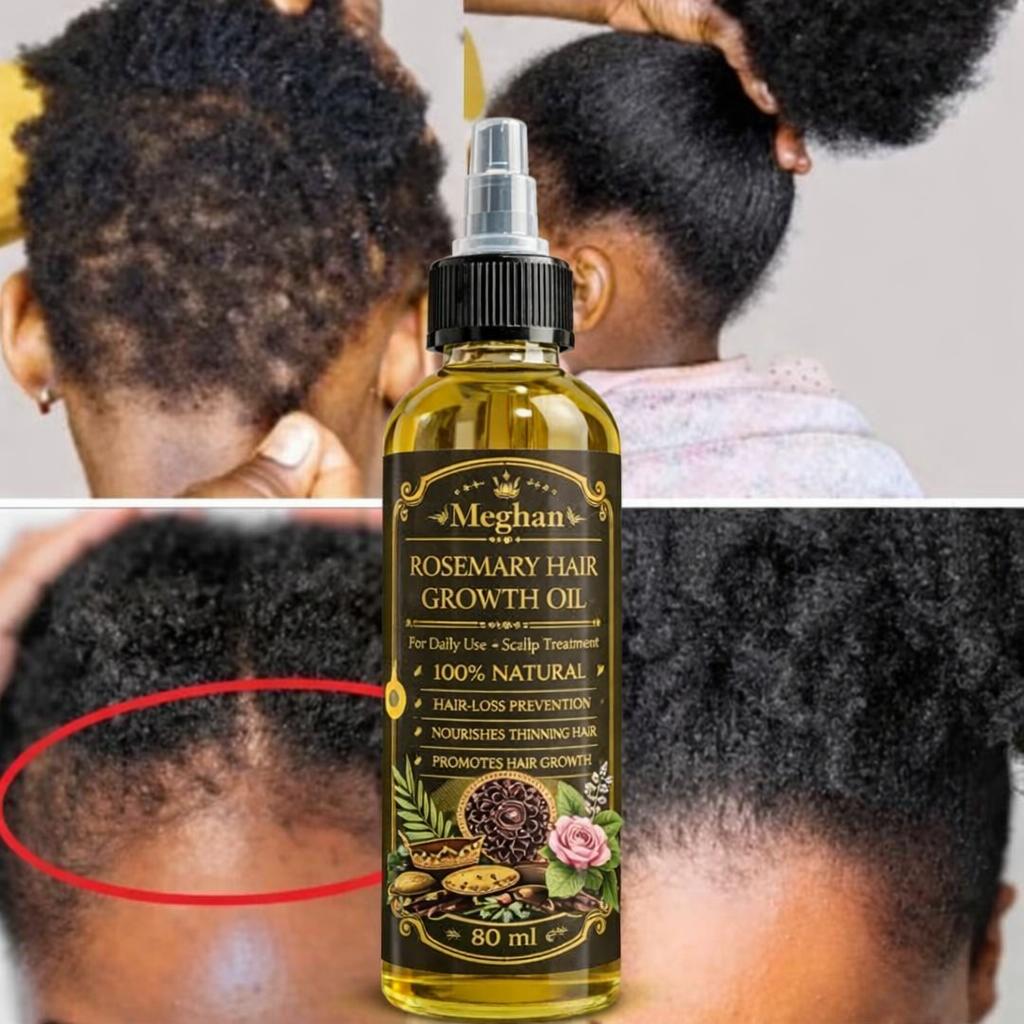 Meghan 2-in-1 Ultimate Hair Growth Duo – Rosemary Oil & Chebe Hair Cream for Stronger, Longer Hair