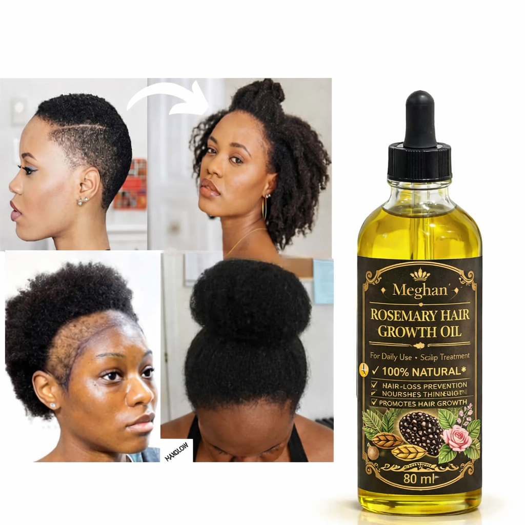 Meghan 2-in-1 Ultimate Hair Growth Duo – Rosemary Oil & Chebe Hair Cream for Stronger, Longer Hair