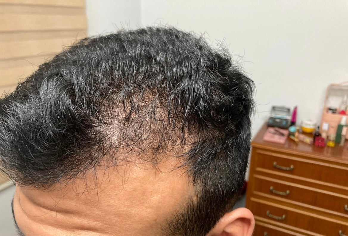 Meghan - Rosemary Hair Growth Oil – Stimulate Stronger, Fuller, Faster-Growing Hair Naturally